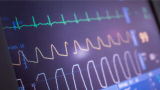Complete Guide to Core Web Vitals